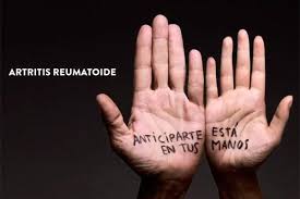 Cómo vencer la artritis reumatoide